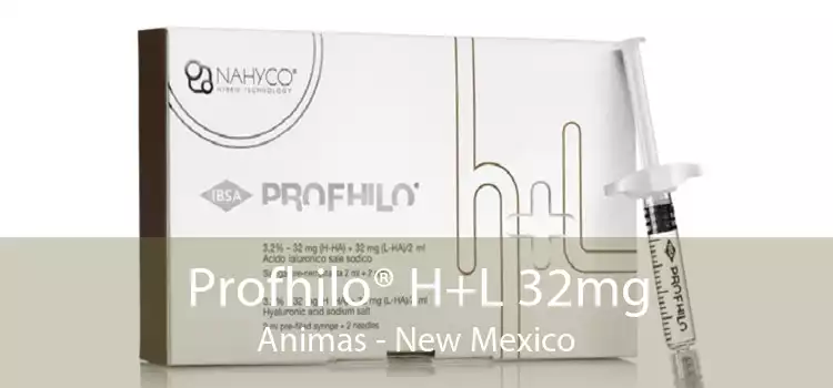 Profhilo® H+L 32mg Animas - New Mexico