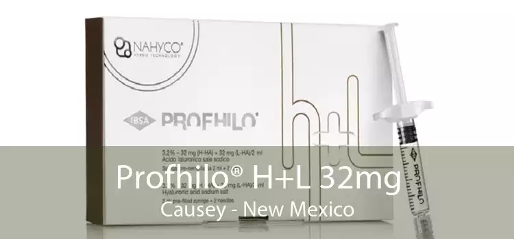 Profhilo® H+L 32mg Causey - New Mexico